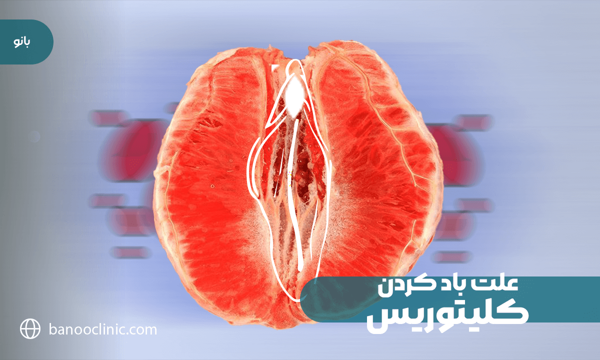 علت بزرگ شدن لابیا مینور؛ بارداری، زایمانهای متعدد و یا تغییرات هورمونی دوران بلوغ